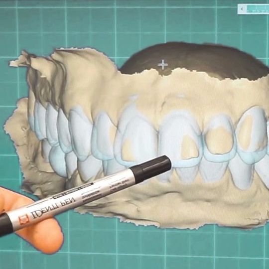 Технология CAD/CAM