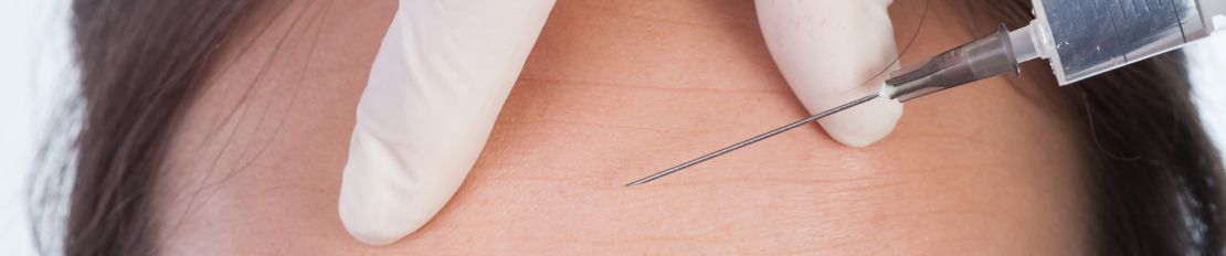 Ботулинотерапия