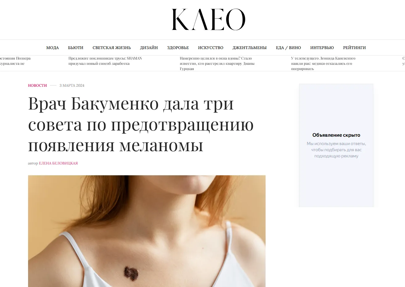 Клео.ру — предотвращение меланомы
