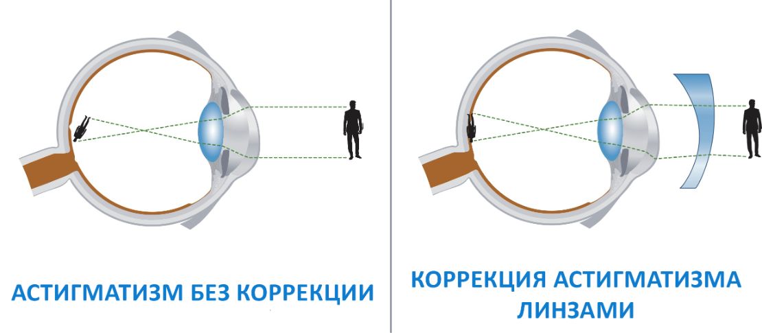 Иногда линзу называют зажигательным стеклом к каким линзам изображенным на рисунке 409