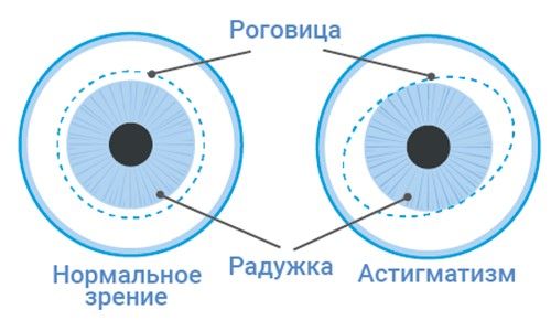 Чертеж для выявления астигматизма