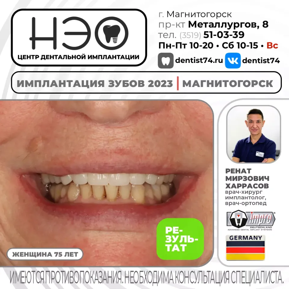 КЕЙС №01/2023 16+ ИМПЛАНТАЦИЯ ЗУБОВ НА ИМПЛАНТАХ IMPRO (Германия) В МАГНИТОГОРСКЕ