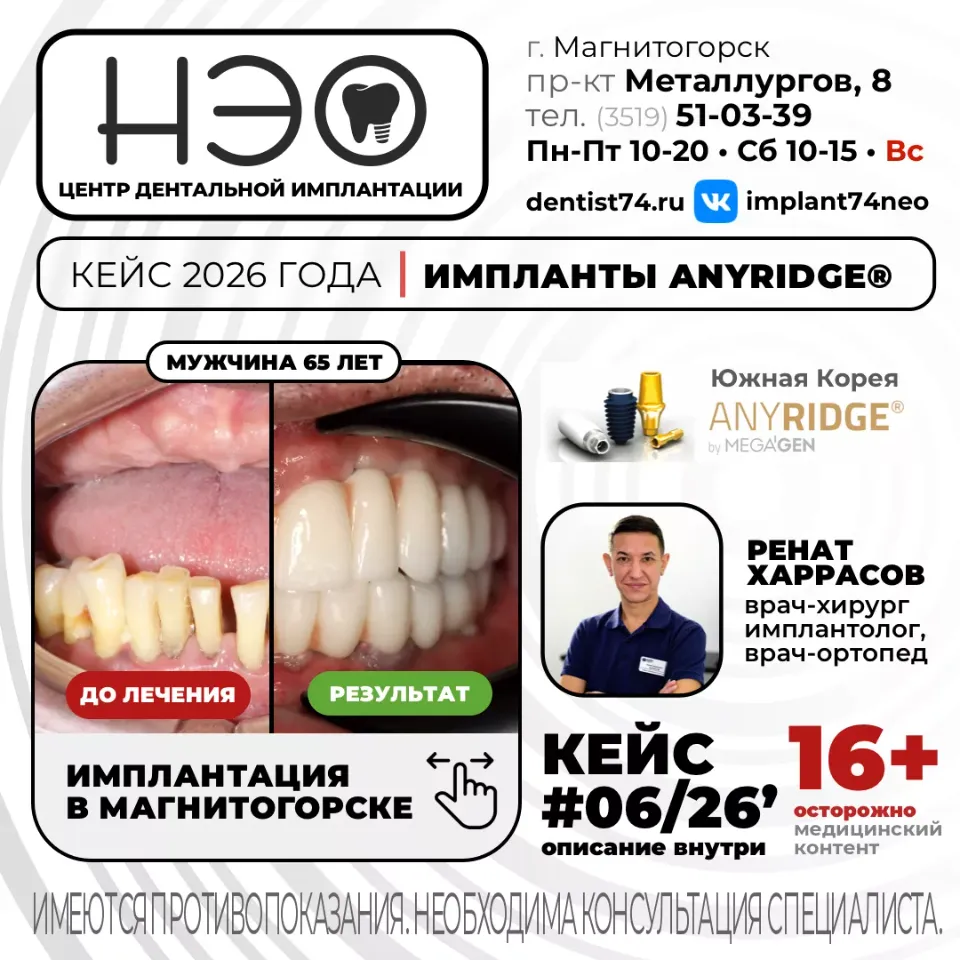 Работы врача хирурга, имплантолога, врача-ортопеда доктора Харрасова Р.М. имплантация зубов в Магнитогорске