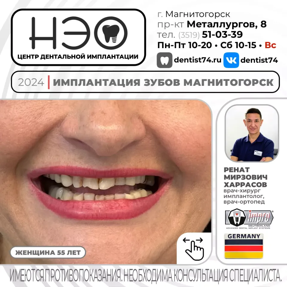 КЕЙС №01/2024 ИМПЛАНТАЦИЯ ЗУБОВ НА ИМПЛАНТАХ IMPRO (ГЕРМАНИЯ) В МАГНИТОГОРСКЕ.