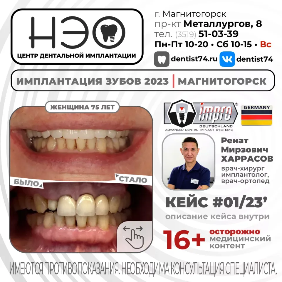 КЕЙС №01/2023 16+ ИМПЛАНТАЦИЯ ЗУБОВ НА ИМПЛАНТАХ IMPRO (Германия) В МАГНИТОГОРСКЕ