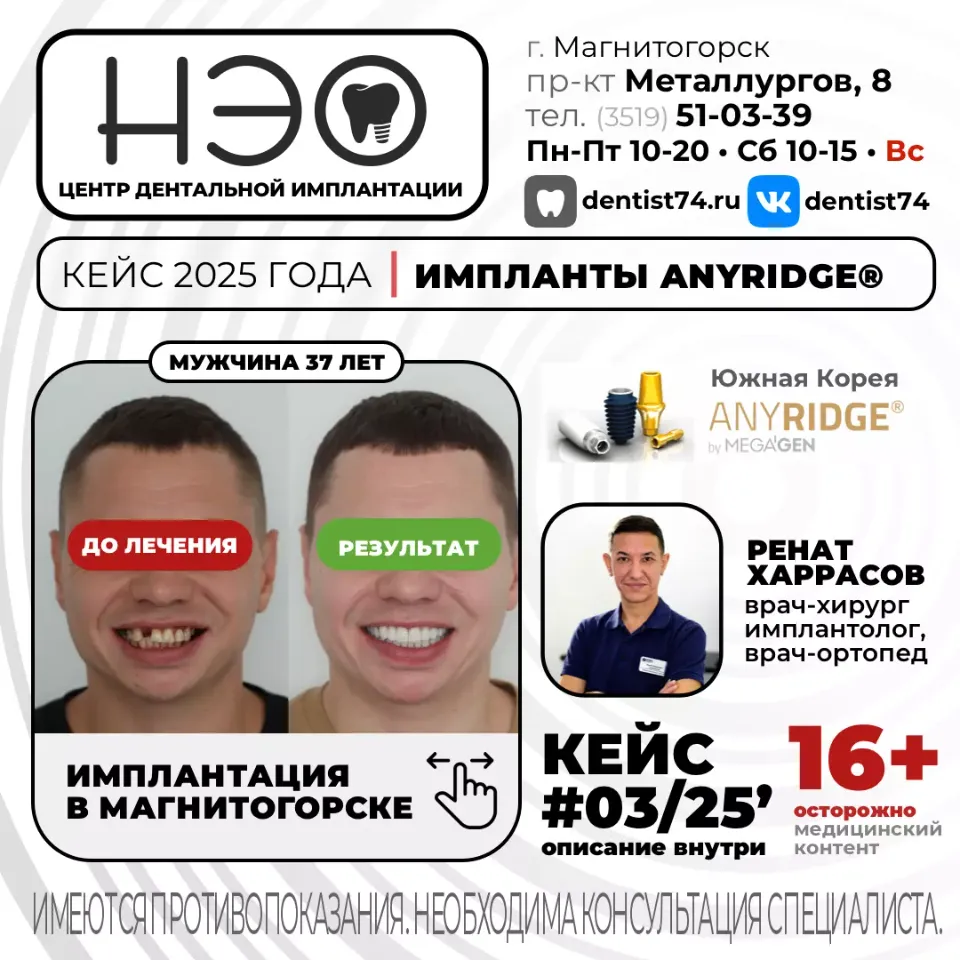 Работы доктора Харрасова Р.М. имплантация зубов в Магнитогорске