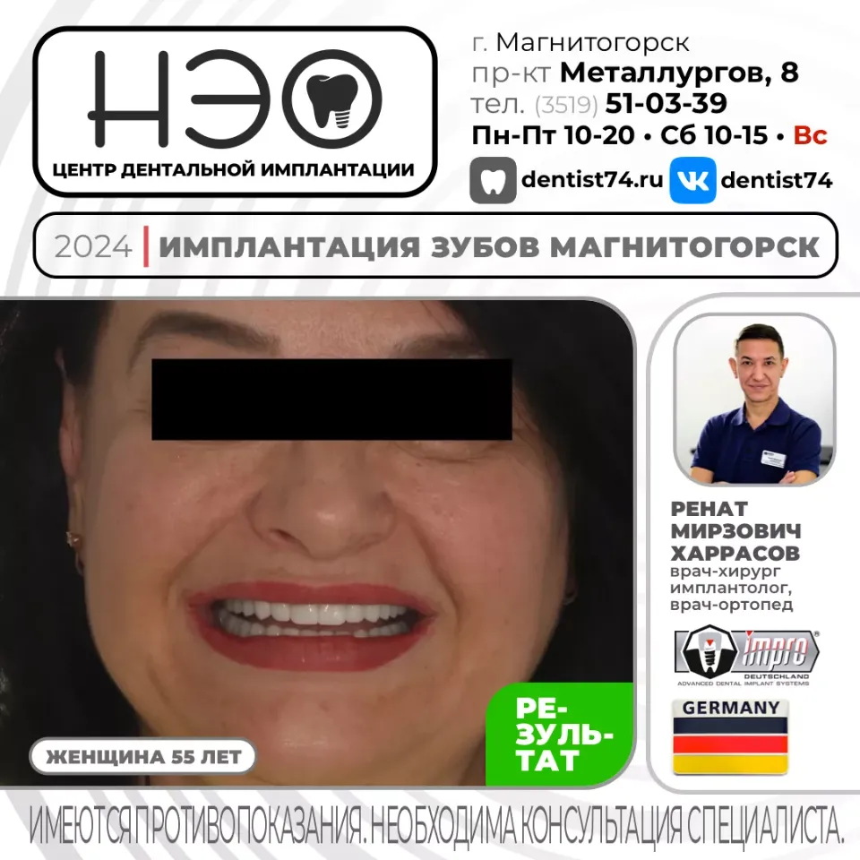 КЕЙС №01/2024 ИМПЛАНТАЦИЯ ЗУБОВ НА ИМПЛАНТАХ IMPRO (ГЕРМАНИЯ) В МАГНИТОГОРСКЕ.