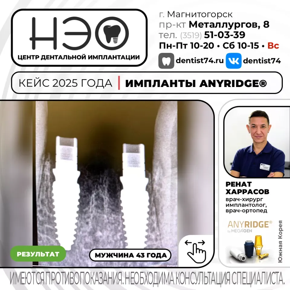 Работы доктора Харрасова Р.М. имплантация зубов в Магнитогорске