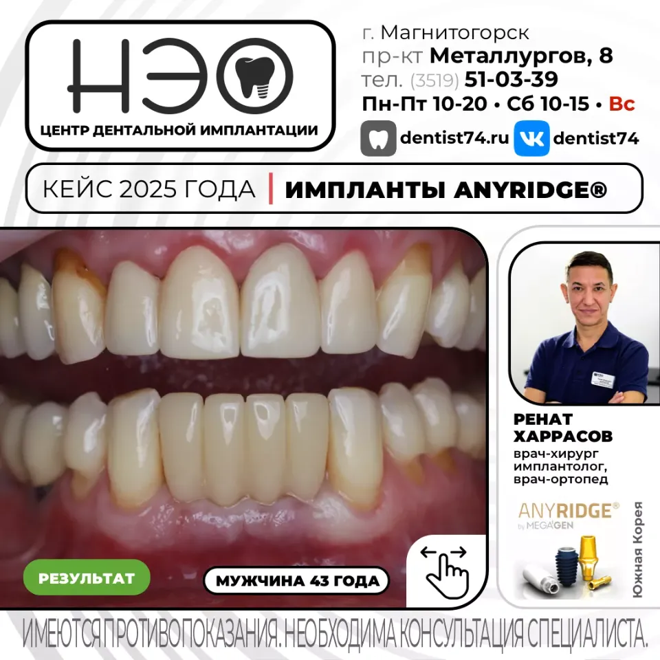 Работы доктора Харрасова Р.М. имплантация зубов в Магнитогорске