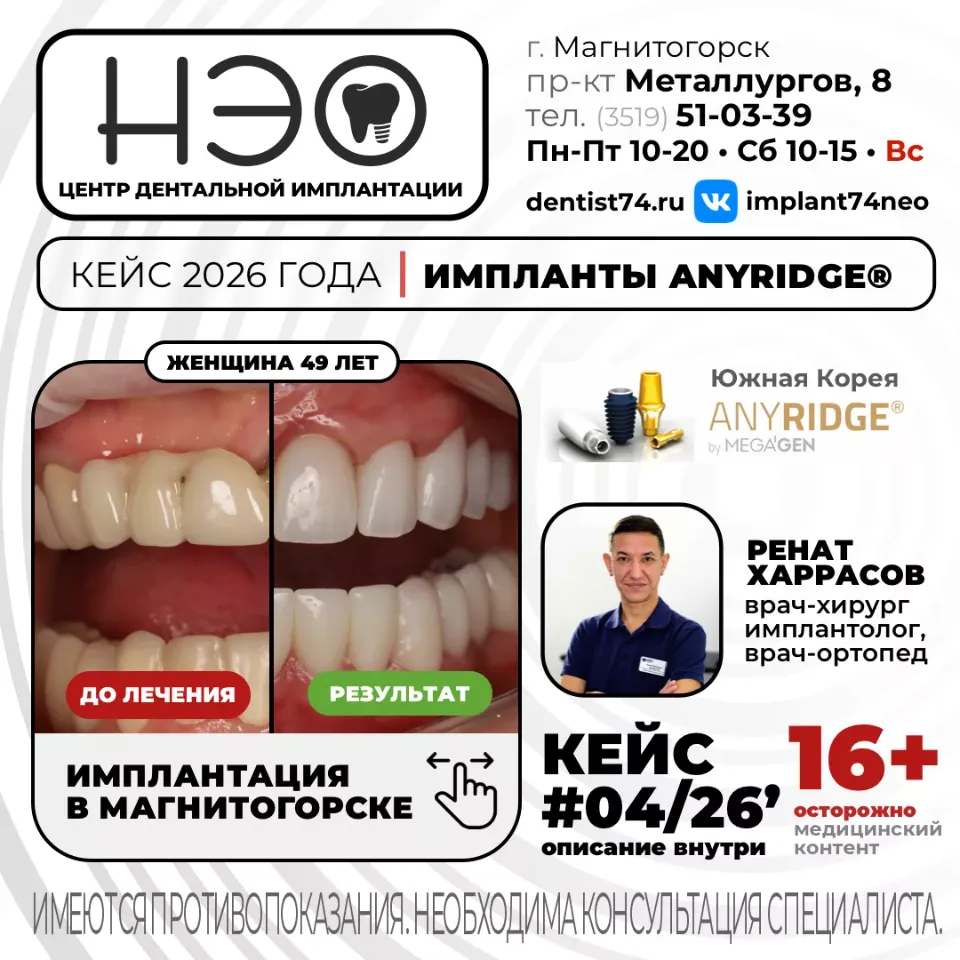 Работы врача хирурга, имплантолога, врача-ортопеда доктора Харрасова Р.М. имплантация зубов в Магнитогорске