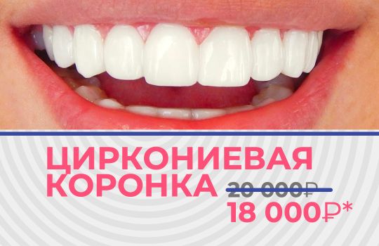 ЦИРКОНИЕВАЯ КОРОНКА установить 18000 вместо 20000 в Магнитогорске
