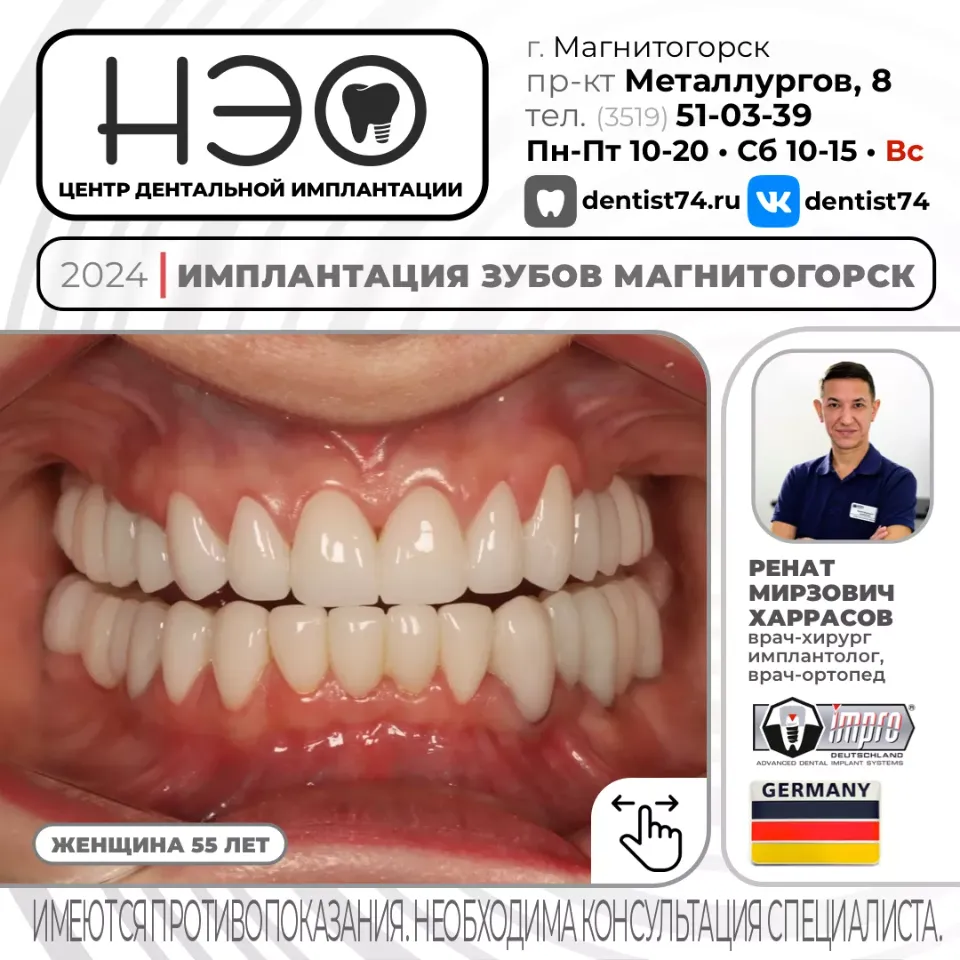 КЕЙС №01/2024 ИМПЛАНТАЦИЯ ЗУБОВ НА ИМПЛАНТАХ IMPRO (ГЕРМАНИЯ) В МАГНИТОГОРСКЕ.