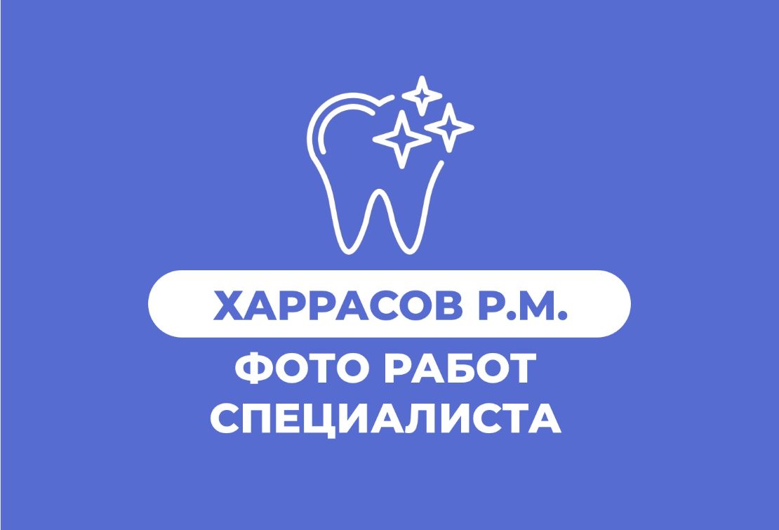 Фото работ Харрасова Рената Мирзовича из Магнитогорска Кейсы имплантации all-on-4 all-on-6 все на 4-х, все на 6-ти