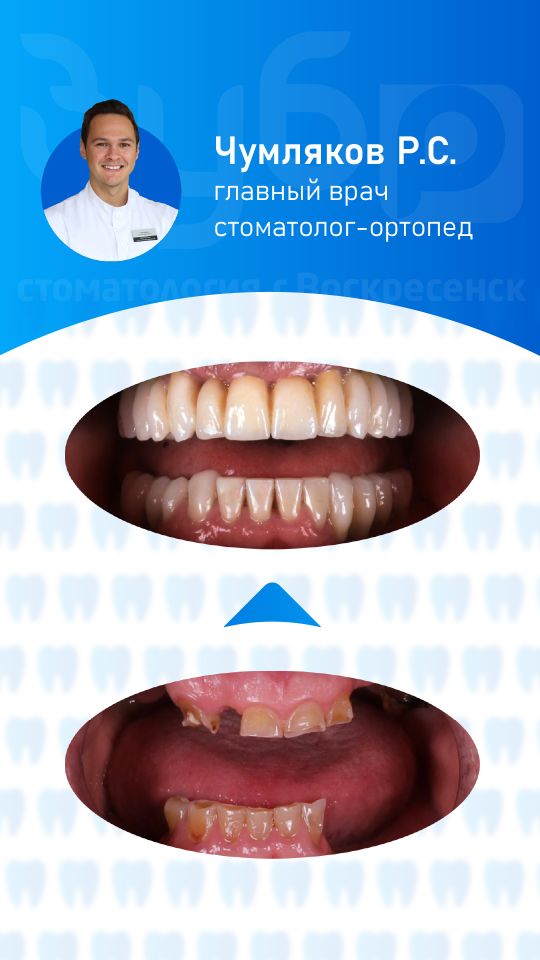 Ортопедические работы Чумляков Роман Сергеевич