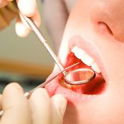 Пародонтология в стоматологии