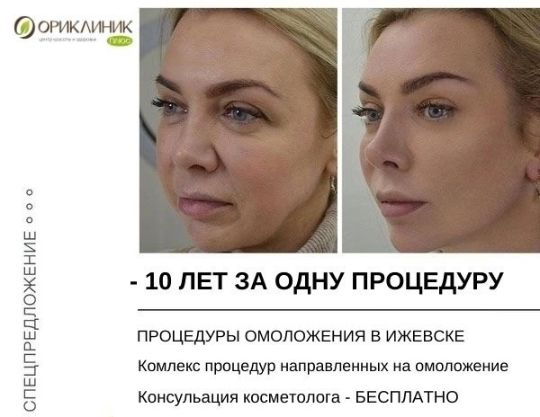 SMAS-ЛИФТИНГ - Ориклиник+