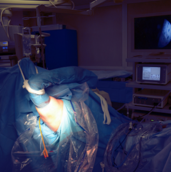 разрыв вращательной манжеты плечевого сустава лечение операция