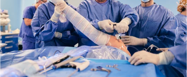 разрыв связок плечевого сустава лечение операция артроскопия