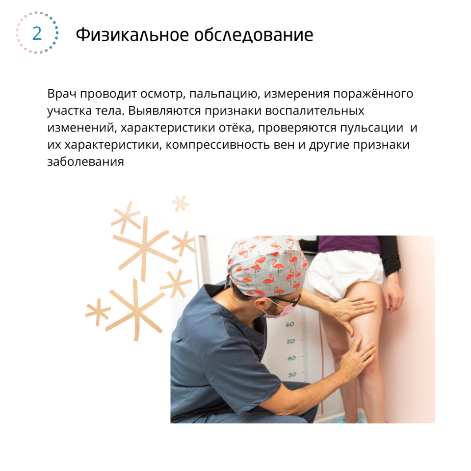 варикоз это