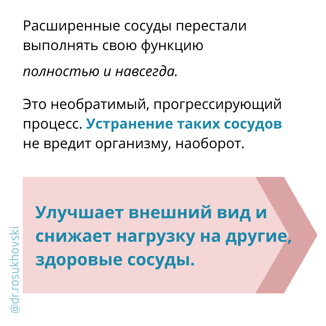 как лечить варикоз