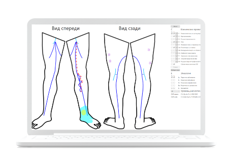 флебологическое картирование
