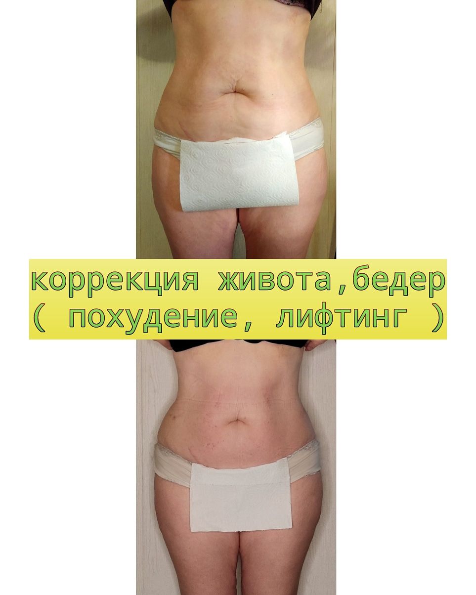 программа на три зоны:живот,бока и ноги сзади