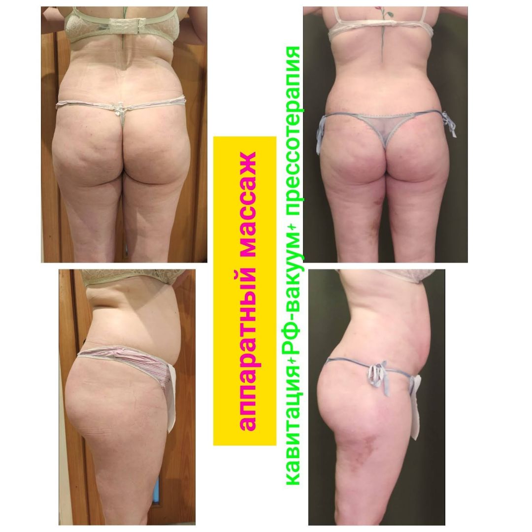 программа на три зоны,живот бока,ноги сзади