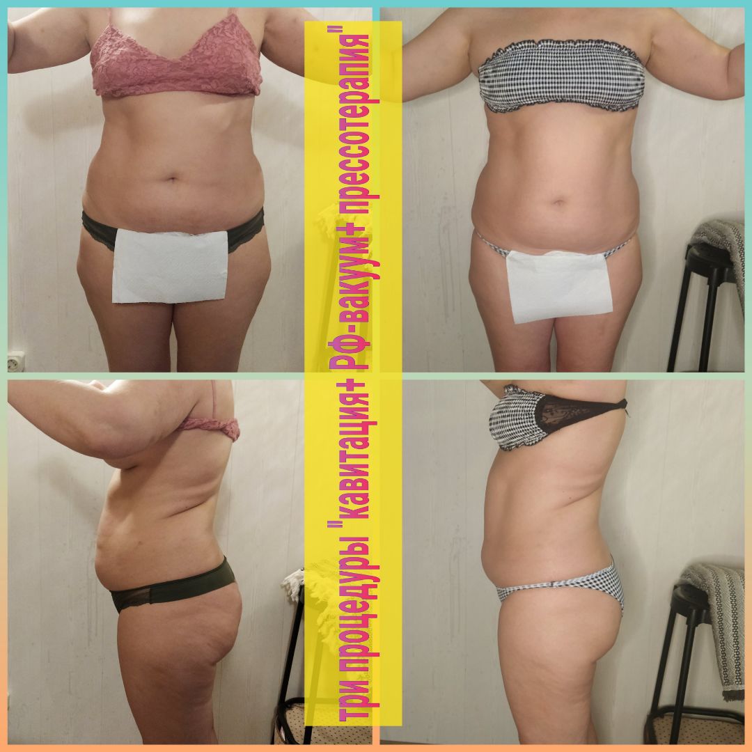 программа на три зоны:живот,бока,ноги сзади