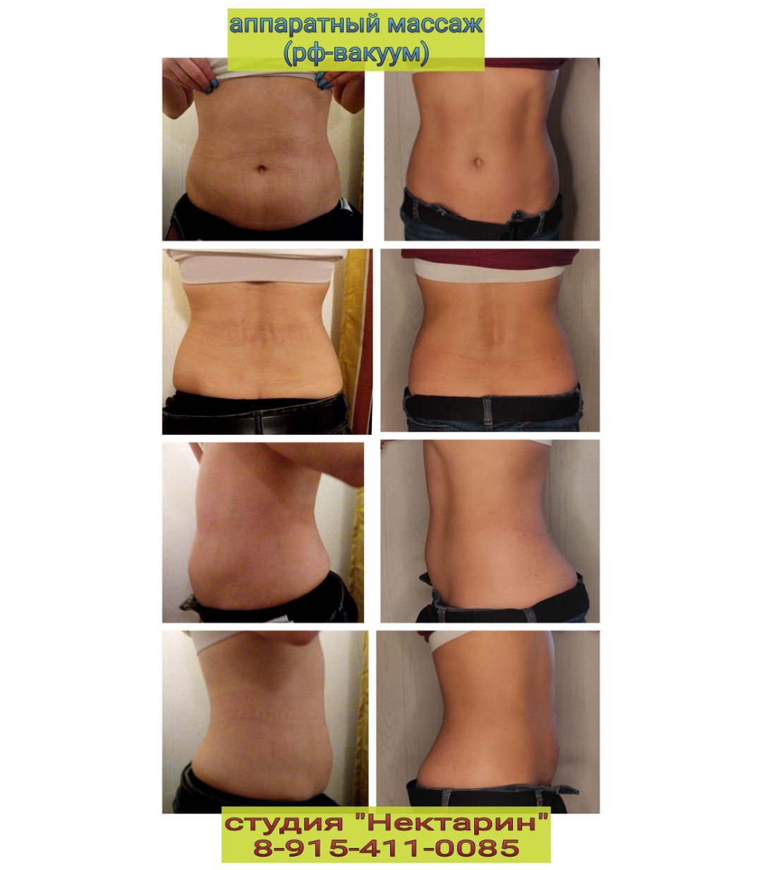 программа на две зоны:живот и бока