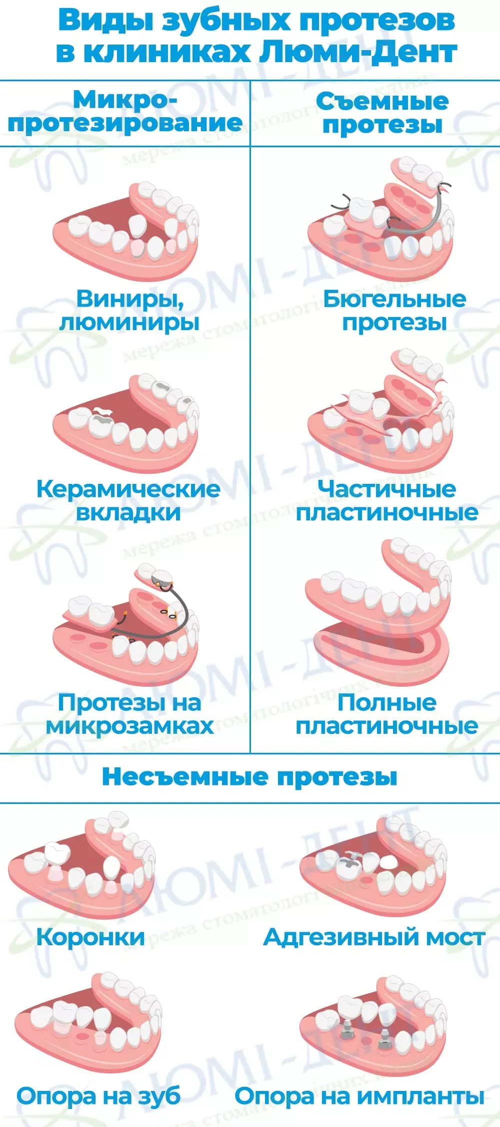 Виды съемных протезов классификация