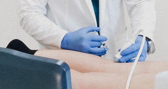 Флебология, лечение варикоза