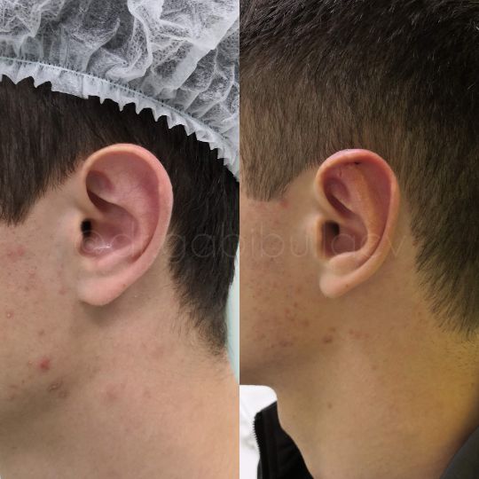 Отопластика Краснодар