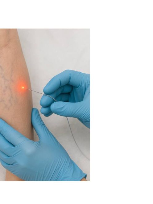 ЭВЛК Краснодар