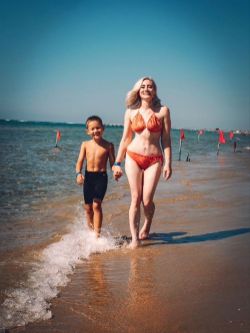 Абдоминопластика Краснодар результаты