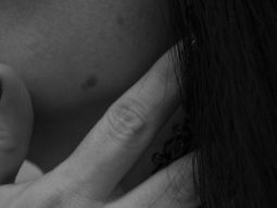 Трихолог Краснодар