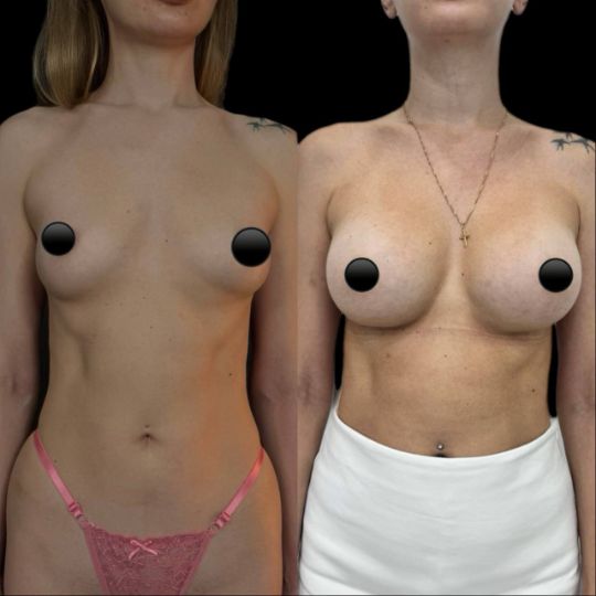 Маммопластика Краснодар