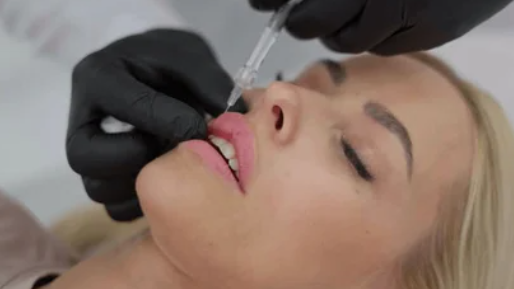 Контурная пластика губ Екатеринбург