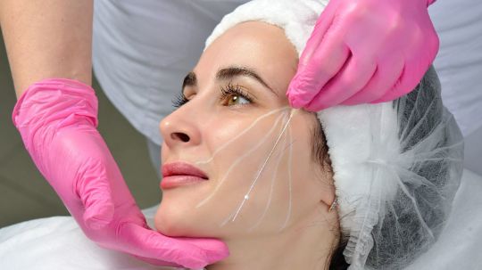 Нитевой лифтинг Екатеринбург