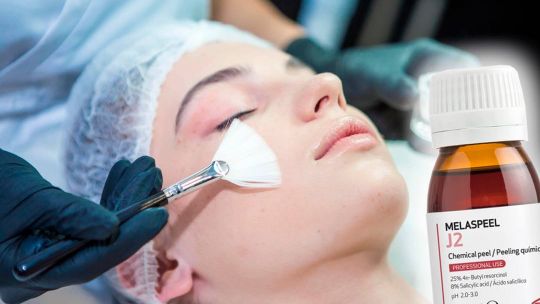 меласпил пилинг лица Екатеринбург