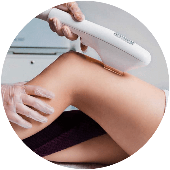 фотоэпиляция IPL Екатеринбург