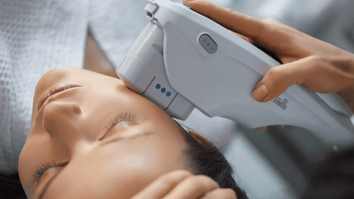 смас-лифтинг Екатеринбург