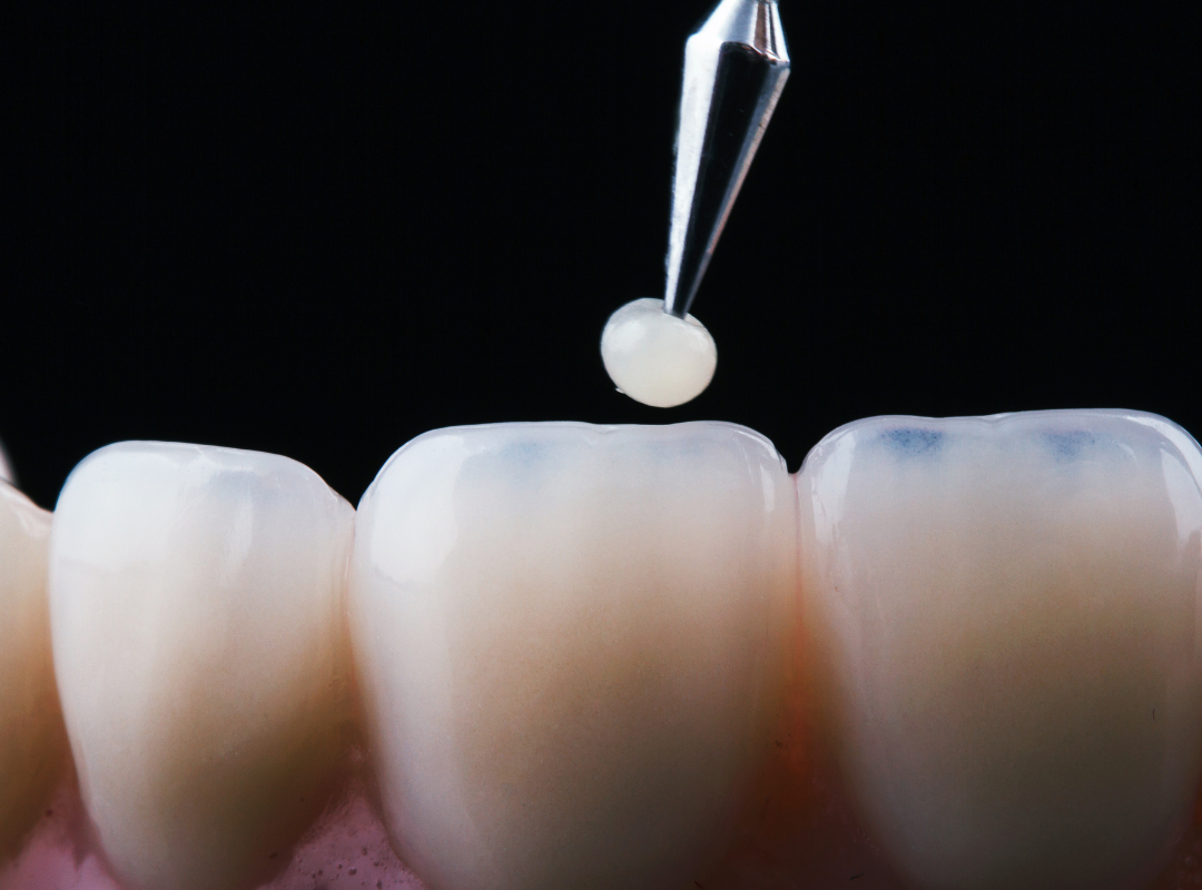 стоматология саларьево тип топ +в саларьево стоматология стоматология филатов луг стоматолог москва сколько стоматологов +в москве хирург стоматолог москва врач стоматолог москва стоматолог ортопед москва стоматолог терапевт москва стоматолог москва цены лучшие стоматологи москвы стоматолог зубов москва стоматолог клиника москве +стоматолог ортодонт москва чистка зубов +у стоматолога москва стоматолог имплантолог москва импланты зубов +в москве имплант зуба цена москва имплант зуба под ключ москва сколько стоит имплант зуба +в москве импланты зубов виды москва импланты зубов виды +и цены +в москве