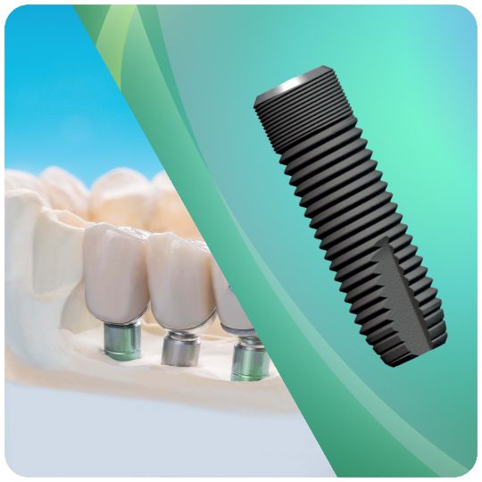 Установка имплантов Astra Tech в клинике дентальной имплантации Апекс-Д. Имплантация по акции 45 000 руб. Гарантия клиники 10 лет.