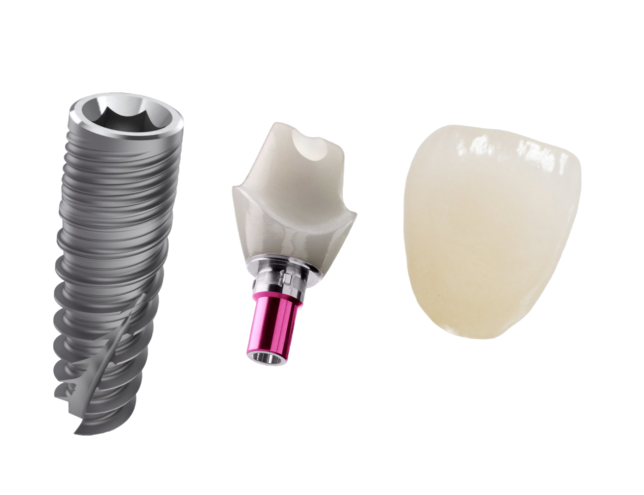 Имплантация зубов под ключ в стоматологии Апекс-Д по цене 46 500 руб. Ставим зубные импланты более 15 лет