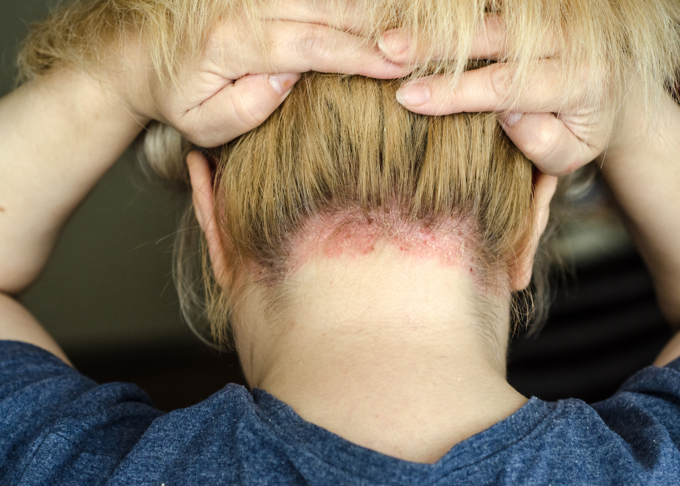 дерматит психосоматика лечение, жкт психосоматика лечение у женщин, лечение аллергии психосоматикой, лечение экземы психосоматика, методы лечения психосоматики, психоанализ москва, психолог щербинка, психосоматика болезней лечение, психосоматика лечение щитовидной железы, биологическое декодирование Щербинка,биологическое декодирование болезней,классическая остеопатия,клиника остеопатии москва Коммунарка,клиника семейной остеопатии Щербинка, сеанс остеопатии,семейная остеопатия, центр остеопатии отзывы, биологическое декодирование болезней Щербинка,боли в плечах и руках лечение Щербинка,боли в плече , левой руки лечение, боли в плече правой руки лечение,боли в правой плече,боли в спине и ноге лечение, боли в спине и пояснице причины лечение,боли в спине лечение области поясницы,боли в спине причины лечение, боли в шее и голове лечение,боли в шее и плечах лечение, боли в шее и плечах причины лечение, боли в шее причины лечение,болит горло психосоматика причины у женщин лечение