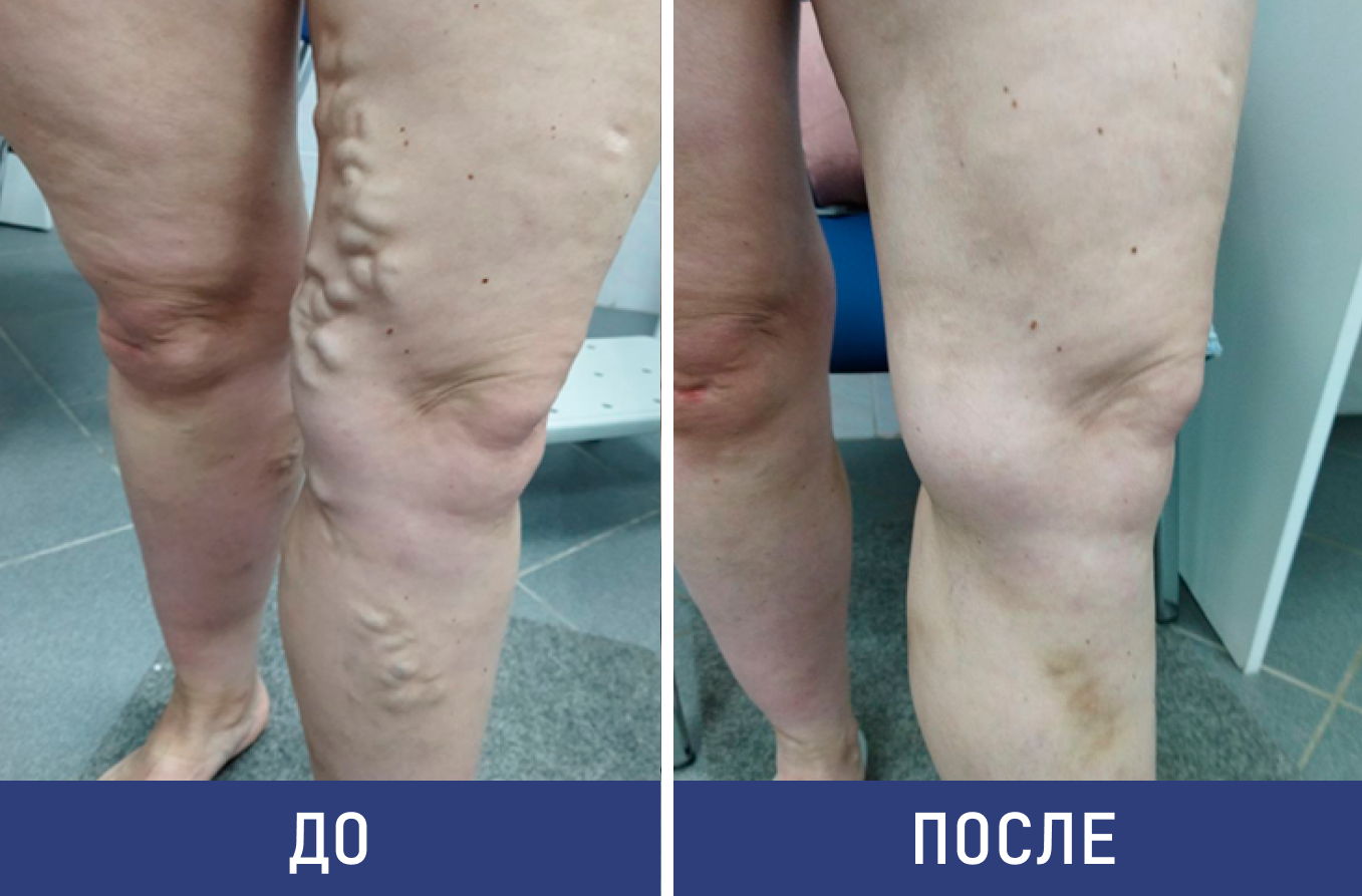 Результаты лечения наших пациентов