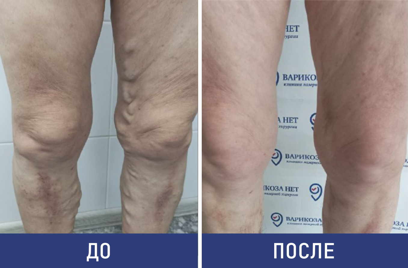 Результаты лечения наших пациентов