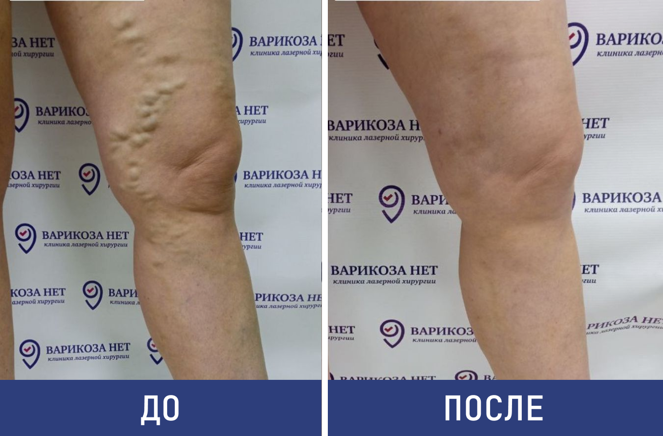 Результаты лечения наших пациентов