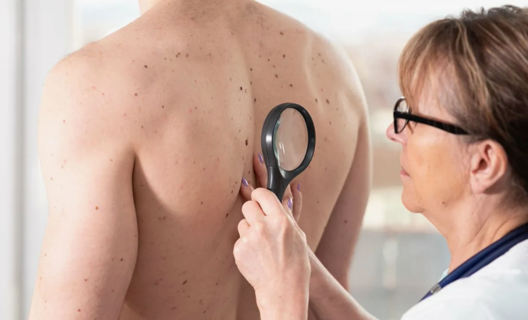 Прием дерматолога дерматовенеролога