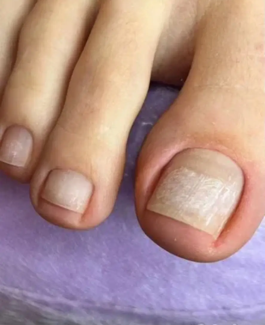 педикюр без покрытия обработка пальчиков